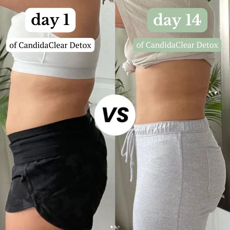 Natruls™ CandidaClear Detox