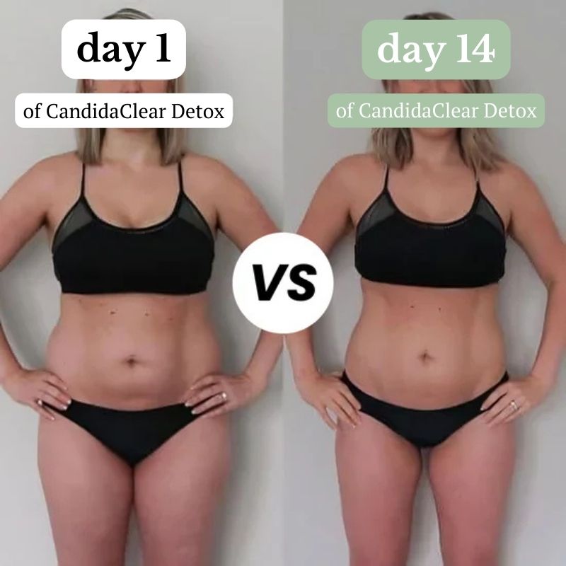 Natruls™ CandidaClear Detox