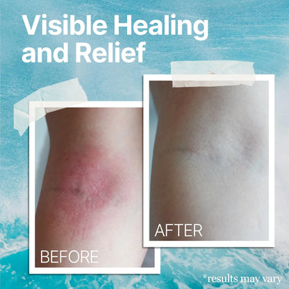 Naturls™ Sea Moss Itch Relief Cream